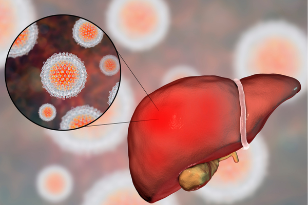 Julho Amarelo: Luta contra as Hepatites Virais